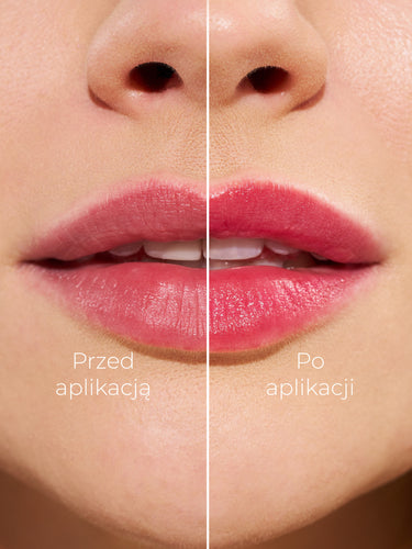 CHAMELEON KOLLEKTION