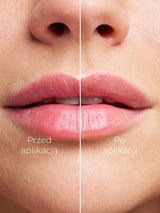 Melon Lip Balm – Melonen-Lippenbalsam