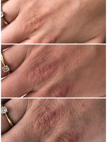 Hudsalva vit E 50 ml - Salbe für trockene Haut