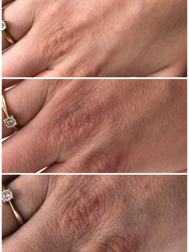 swederm Hudsalva vit E- Salbe für trockene Haut